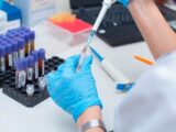 Cyberatak na laboratoria Optimed: potencjalny wyciek danych pacjentów