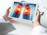 Polska Pulmonologia na Nowym Kursie: Wdrożenie Rewolucyjnych Zmian i Programów Przesiewowych